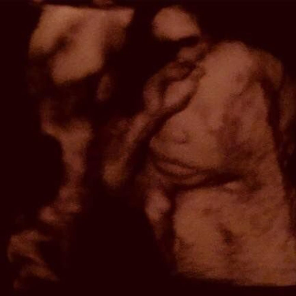 Meet your Posher, Essene janell